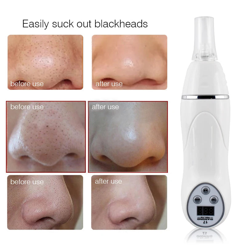 Diamond Dermabrasion Blackhead Removal Machine Vacuum Face Suction Skin Clean Facial Massage Peeling Acne Pore Beauty Device